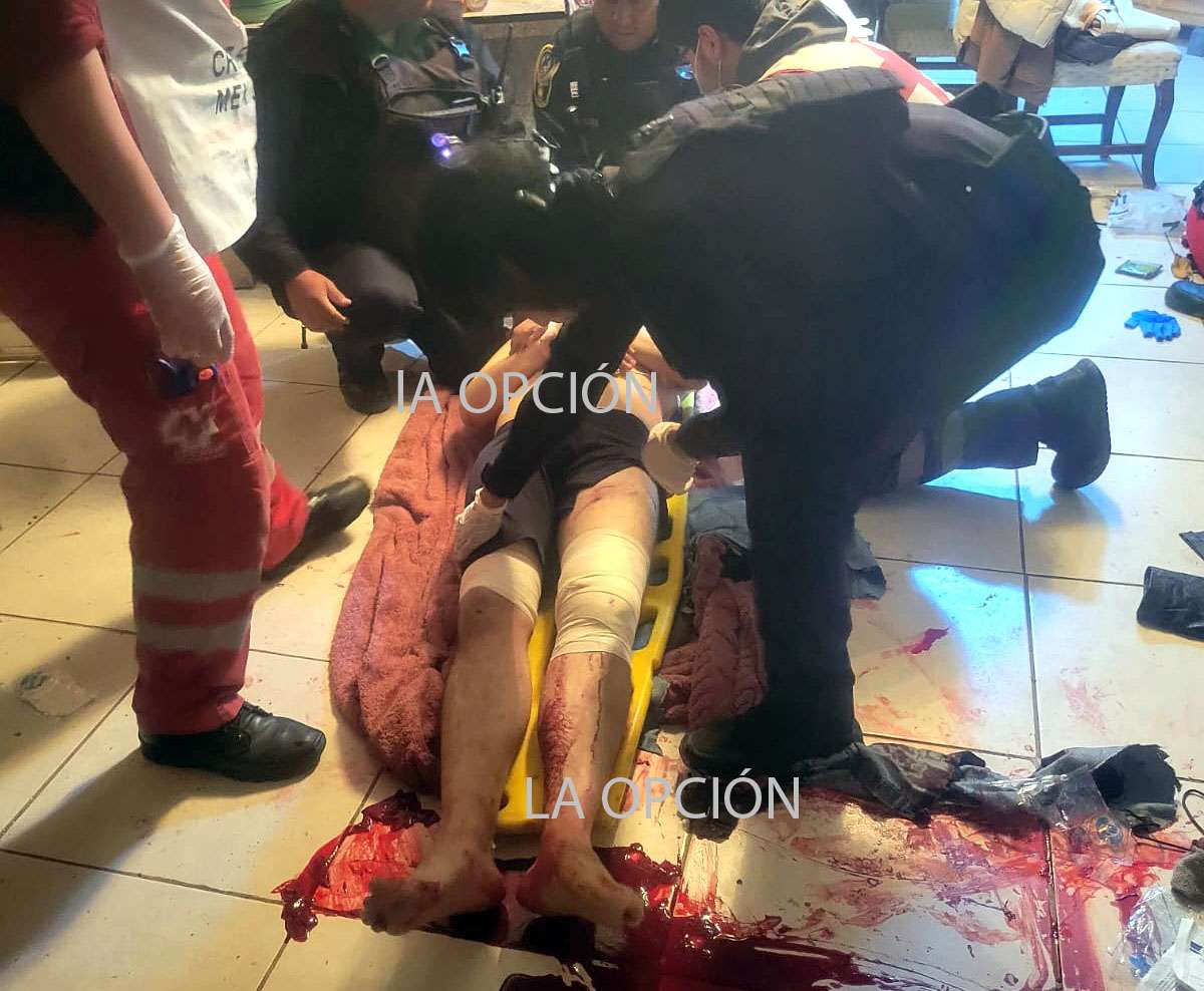 Identifican a baleado por policía luego machetear a un perro del K9